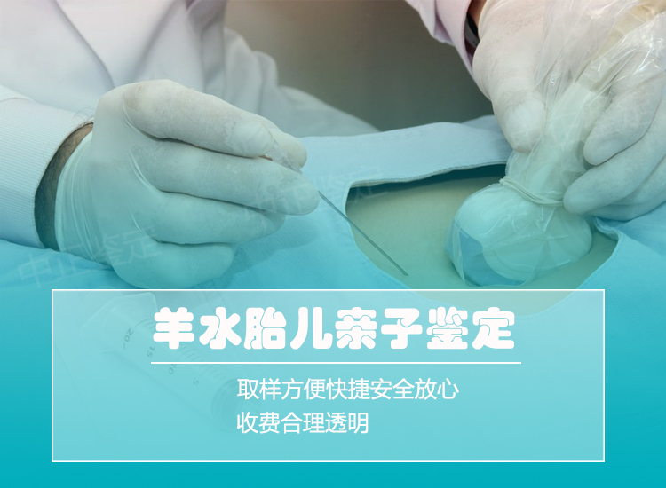 舟山羊水孕期亲子鉴定